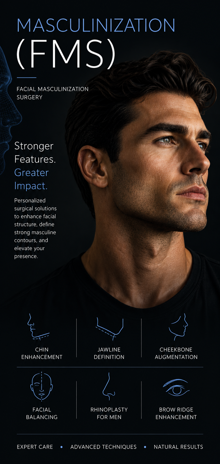 Facial masculinization surgery in Monterrey, Mexico - custom implant results